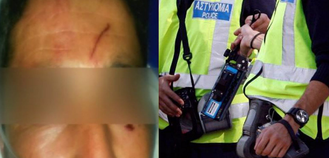 ΠΑΦΟΣ: Άγριος ξυλοδαρμός δύο ανδρών από αστυνομικούς – Τι υποστηρίζουν τα «θύματα» και τι η Αστυνομία - VIDEO