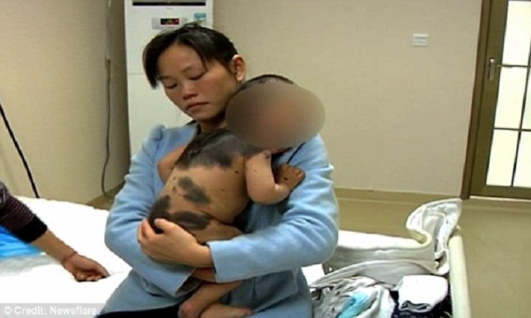 Κίνα: Το αγόρι που μετατρέπεται σε… αρκουδάκι! (ΦΩΤΟΓΡΑΦΙΕΣ-ΒΙΝΤΕΟ)
