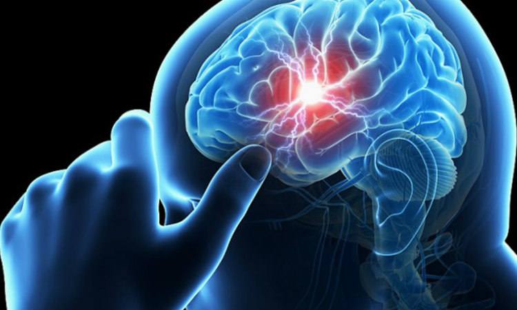 Εγκεφαλικό: Τα συμπτώματα και πως να τα αναγνωρίσετε