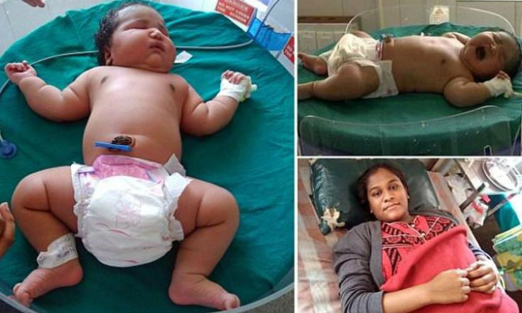 Γεννήθηκε μωρό – «γίγαντας» στην Ινδία (Φωτογραφίες)