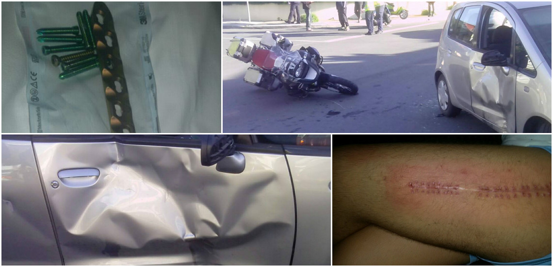ΛΕΜΕΣΟΣ: Φωτογραφίες από τροχαίο που προκαλούν σοκ – Πώς γλίτωσαν οι δυο μοτοσικλετιστές