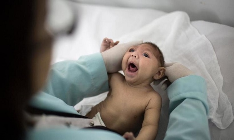 Το πρώτο μωρό στην Ευρώπη με μικροκεφαλία από τον ιό Ζίκα