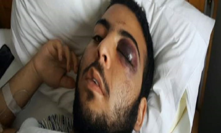 Ξυλοκόπησαν άγρια 17χρονο έξω από μαγαζί στο Γκάζι -Του έσπασαν τα κόκαλα στο πρόσωπο  - VIDEO