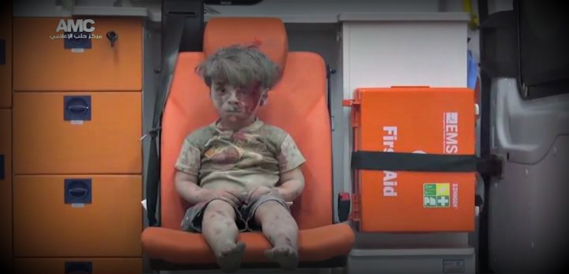 Έτσι είναι σήμερα το αγόρι σύμβολο της Συρίας που συγκλόνισε την ανθρωπότητα - VIDEO