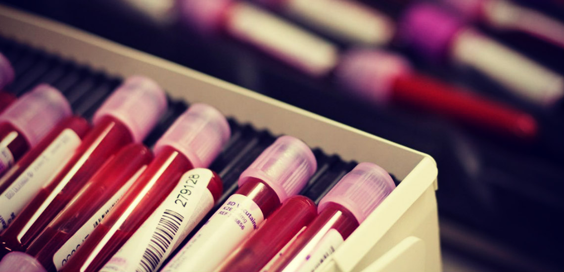 Τεστ αίματος μπορεί να ανιχνεύσει τον καρκίνο και να εντοπίσει πού αναπτύσσεται