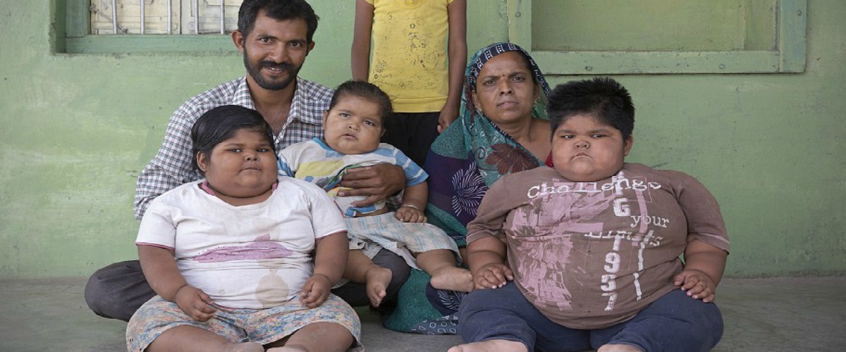 Τι κάνει η φτώχεια: Πατέρας πουλάει το νεφρό του για να αδυνατίσουν τα παχύσαρκα παιδιά του