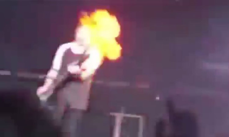 Πήρε φωτιά on stage - Τα επικίνδυνα εφέ τον έστειλαν στο νοσοκομείο (ΦΩΤΟ - ΒΙΝΤΕΟ)