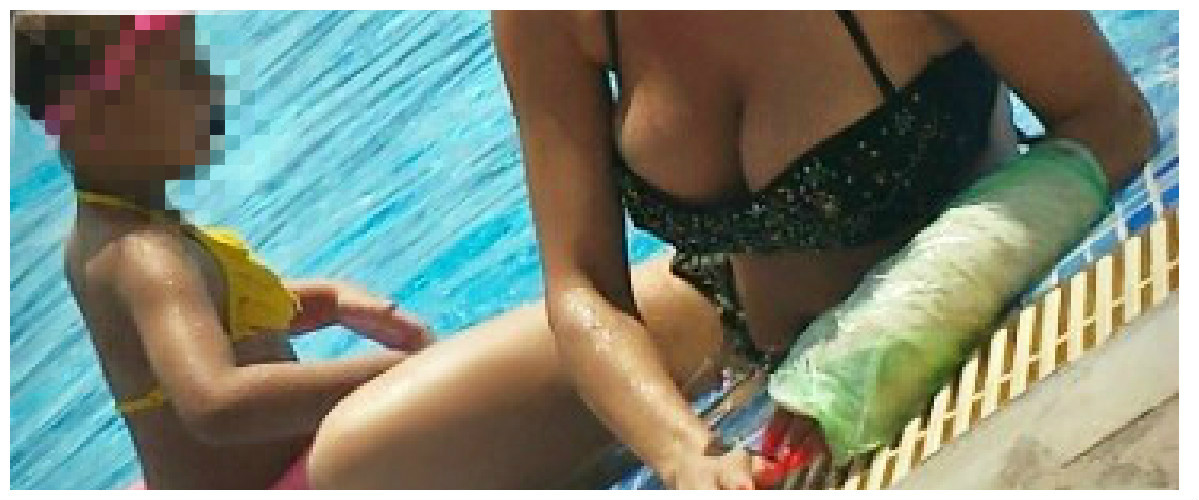 Βρε την αθεόφοβη! Με το χέρι στο γύψο η Κύπρια celebrity έκανε super sexy εμφάνιση σε πισίνα (ΦΩΤΟ)
