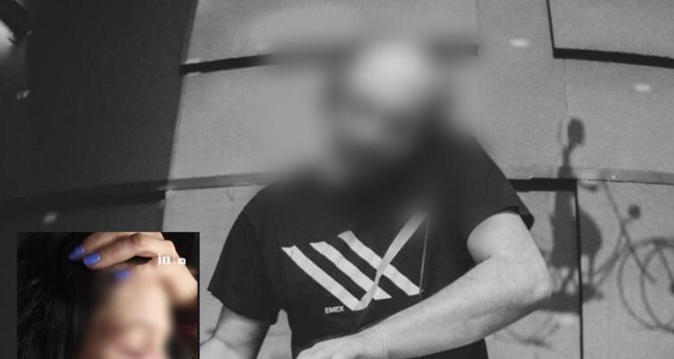 Πασίγνωστος dj μηνύθηκε για ξυλοδαρμό σε βάρος της συντρόφου του – Σοκαριστικές φωτογραφίες της 33χρονης με τους μώλωπες
