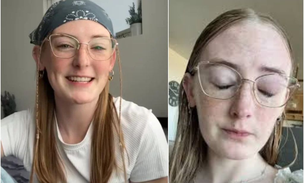 Νεαρή γυναίκα έκανε μπάνιο με τους φακούς επαφής και έχασε την όρασή της μέσα σε λίγες μέρες - Τι συνέβη 