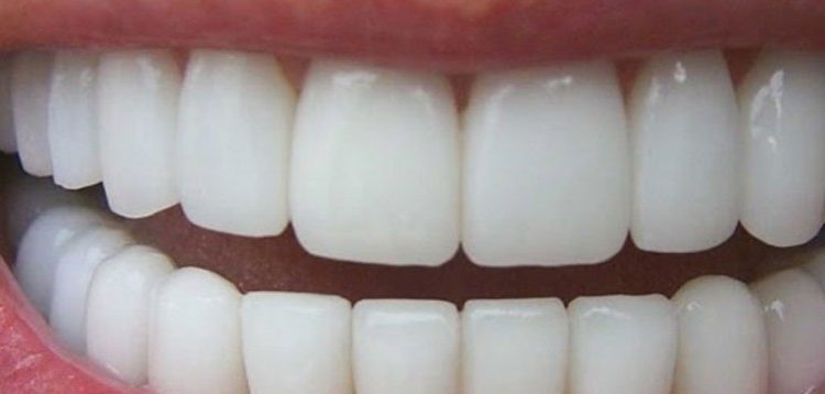 Τα τρία φρούτα που λειτουργούν σαν φυσικά λευκαντικά για τα δόντια μας