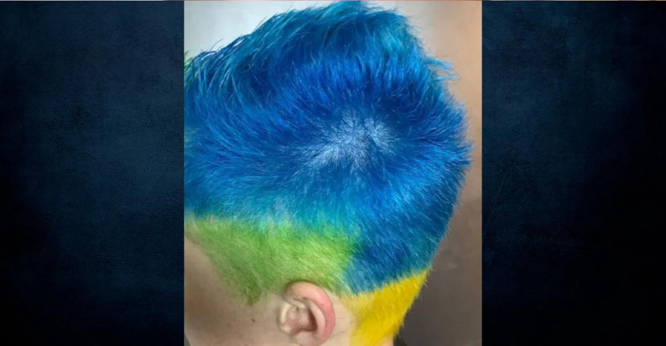 Ρωσία: Πρόστιμο σε άνδρα που έβαψε τα μαλλιά του στα χρώματα της Ουκρανίας