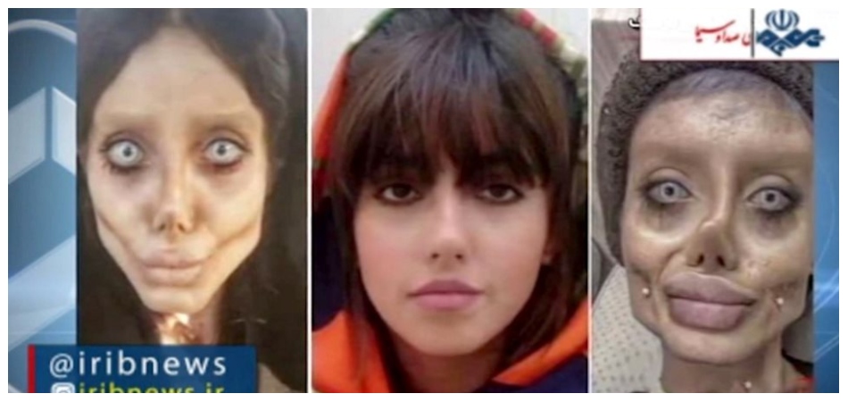 Η Ιρανή σταρ του Instagram που θύμιζε «ζόμπι εκδοχή» της Τζολί καταδικάστηκε σε δέκα χρόνια φυλακή