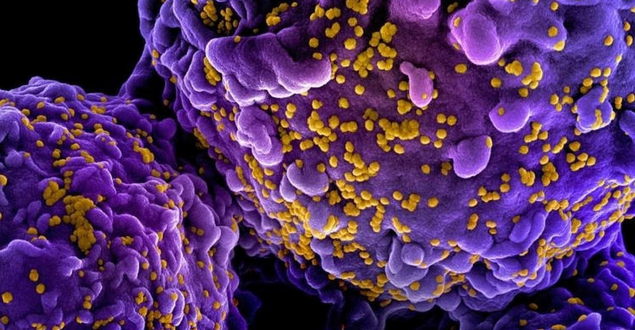 Νέο φάρμακο προλαμβάνει τον HIV με δύο ενέσεις τον χρόνο – «Ορόσημο» κατά της παγκόσμιας επιδημίας