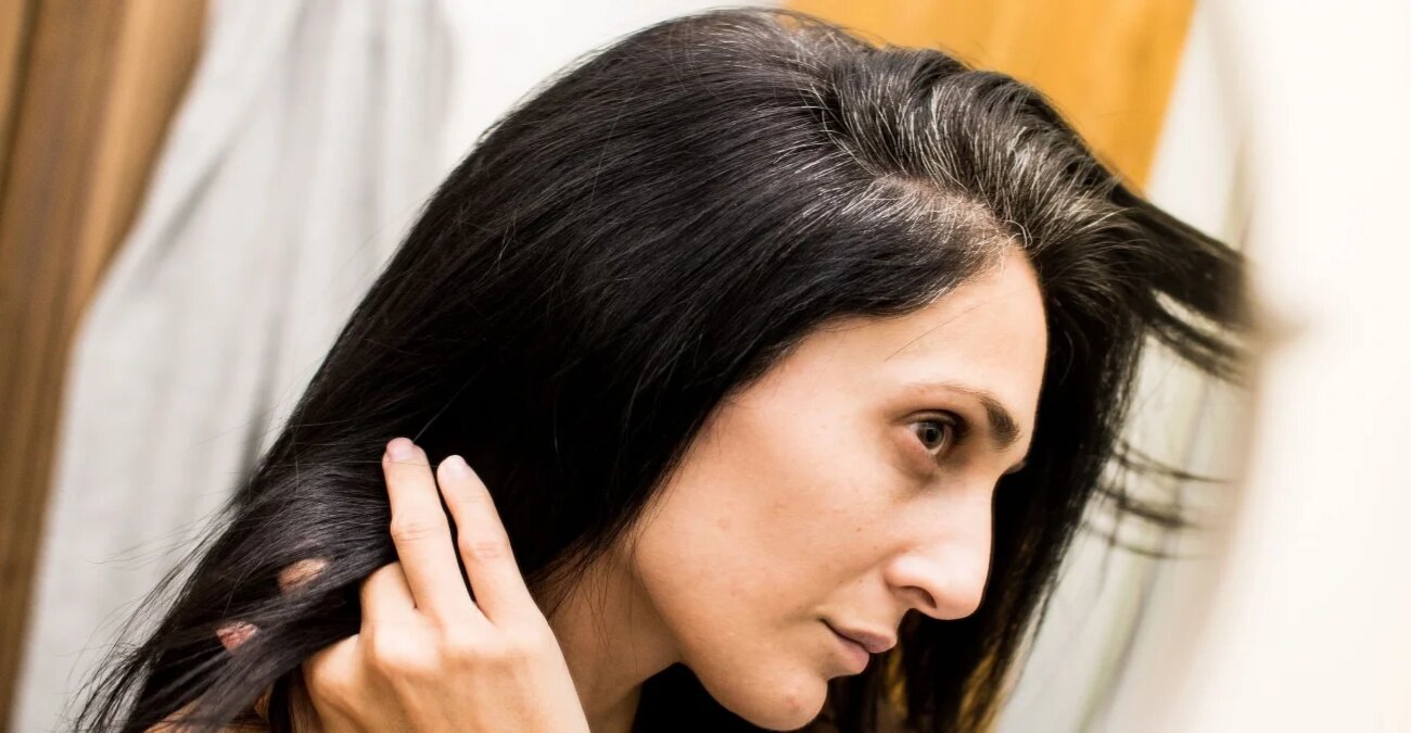 Πρόωρο γκριζάρισμα στα μαλλιά: Ποια τα αίτια – Αντιστρέφεται η εξέλιξη;