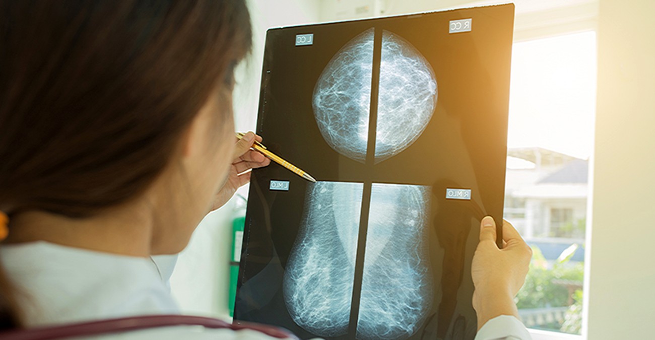 Καρκίνος του μαστού: Επεκτείνεται το όριο ηλικίας για έλεγχο με απόφαση Υπουργικού - Όλες οι πληροφορίες