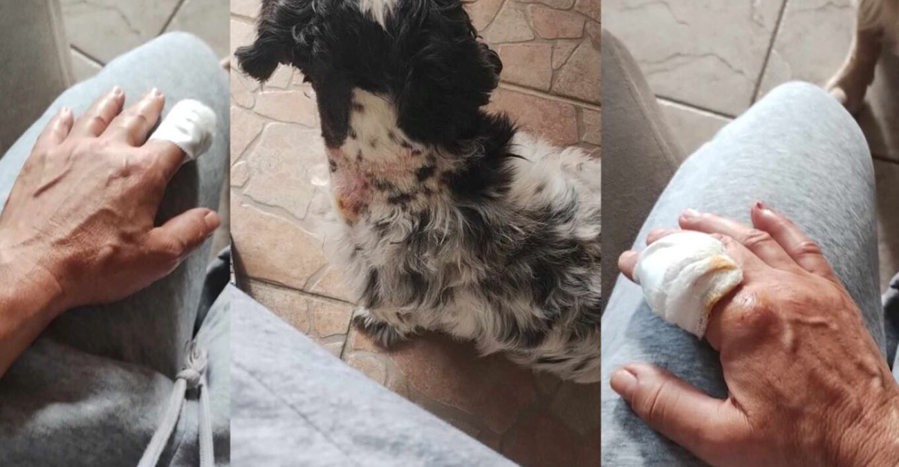 Ηγουμενίτσα: Γυναίκα δέχθηκε επίθεση από πιτ μπουλ - Τραυμάτισε την ίδια και το σκυλάκι της