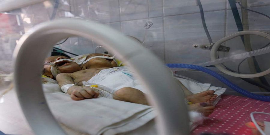Έζησαν μόνο για 14 ημέρες: Δίδυμα έσβησαν επειδή δεν μπορούσαν να τα στείλουν από την Υεμένη στο εξωτερικό 