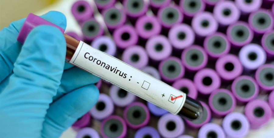 ΚΥΠΡΟΣ – ΚΟΡΩΝΟΪΟΣ: Είχε επιστρέψει με αρνητικό τεστ του ιού - Φαίνεται οτι της μετέδωσε τον Covid-19 η μητέρα της
