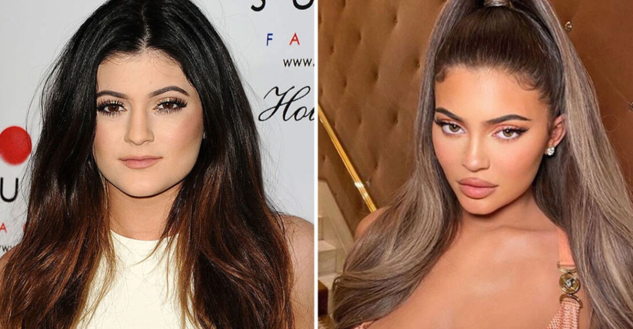 Kylie Jenner: «Δεν είμαι τόσο πλαστική» – Οι αντιδράσεις στα social media για την ατάκα της