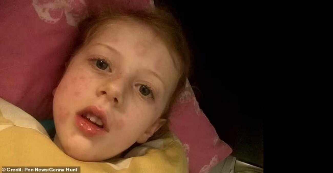 Τρόμος στην Βρετανία: Κοριτσάκι πέντε χρονών γέμισε εξανθήματα και κατέληξε να μην μπορεί να περπατήσει - Ποιος ο λόγος