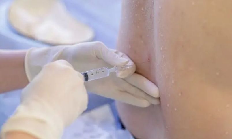 Αυτές είναι οι πιο επώδυνες επεμβάσεις σύμφωνα με ειδικούς – Τι λέει η επιστήμη για τον πόνο