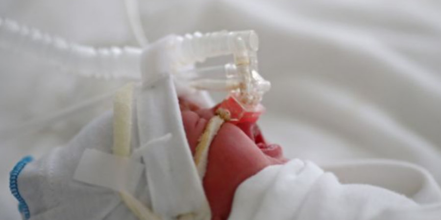 Μωρό γεννήθηκε πρόωρα με… ουρά 12 εκατοστών – Τι συνέβη