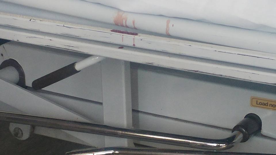 ΝΟΣΟΚΟΜΕΙΟ ΛΕΜΕΣΟΥ: Εικόνες ντροπής από θάλαμο ασθενών – Αίματα στο κρεβάτι και κατεστραμμένες καρέκλες –ΦΩΤΟΓΡΑΦΙΕΣ