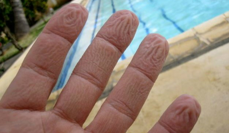 Γιατί ζαρώνουν τα δάχτυλά σας μέσα στο νερό – Όχι, δεν είναι επειδή «μούλιασαν»