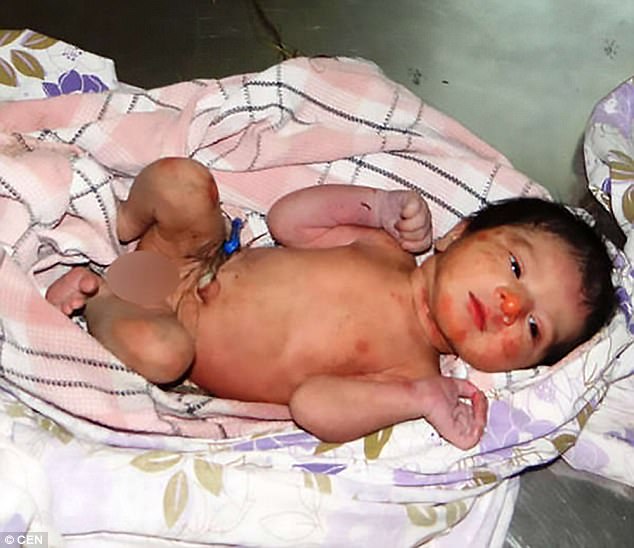 Γονείς πέταξαν το νεογέννητο κοριτσάκι τους σε θάμνο με αγκάθια για να πεθάνει- Προτιμούσαν αγόρι - ΦΩΤΟΓΡΑΦΙΕΣ