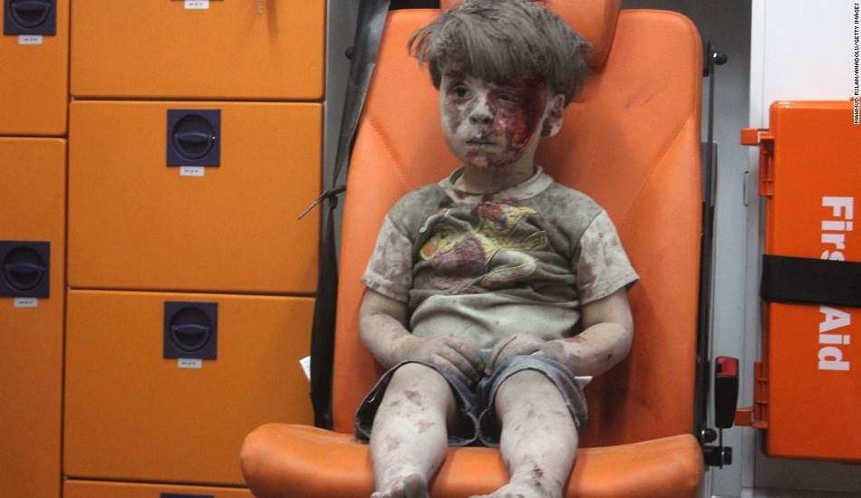 Ετσι είναι σήμερα το αγοράκι που έγινε σύμβολο του πολέμου στην Συρία -Ηταν μέσα στα αίματα, με το βλέμμα χαμένο - BINTEO